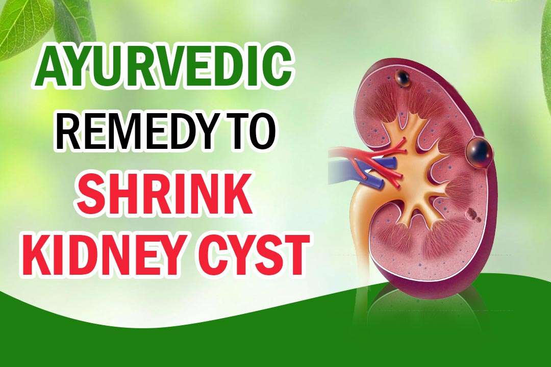 Efficient Ayurvedic remedies to shrink kidney cyst