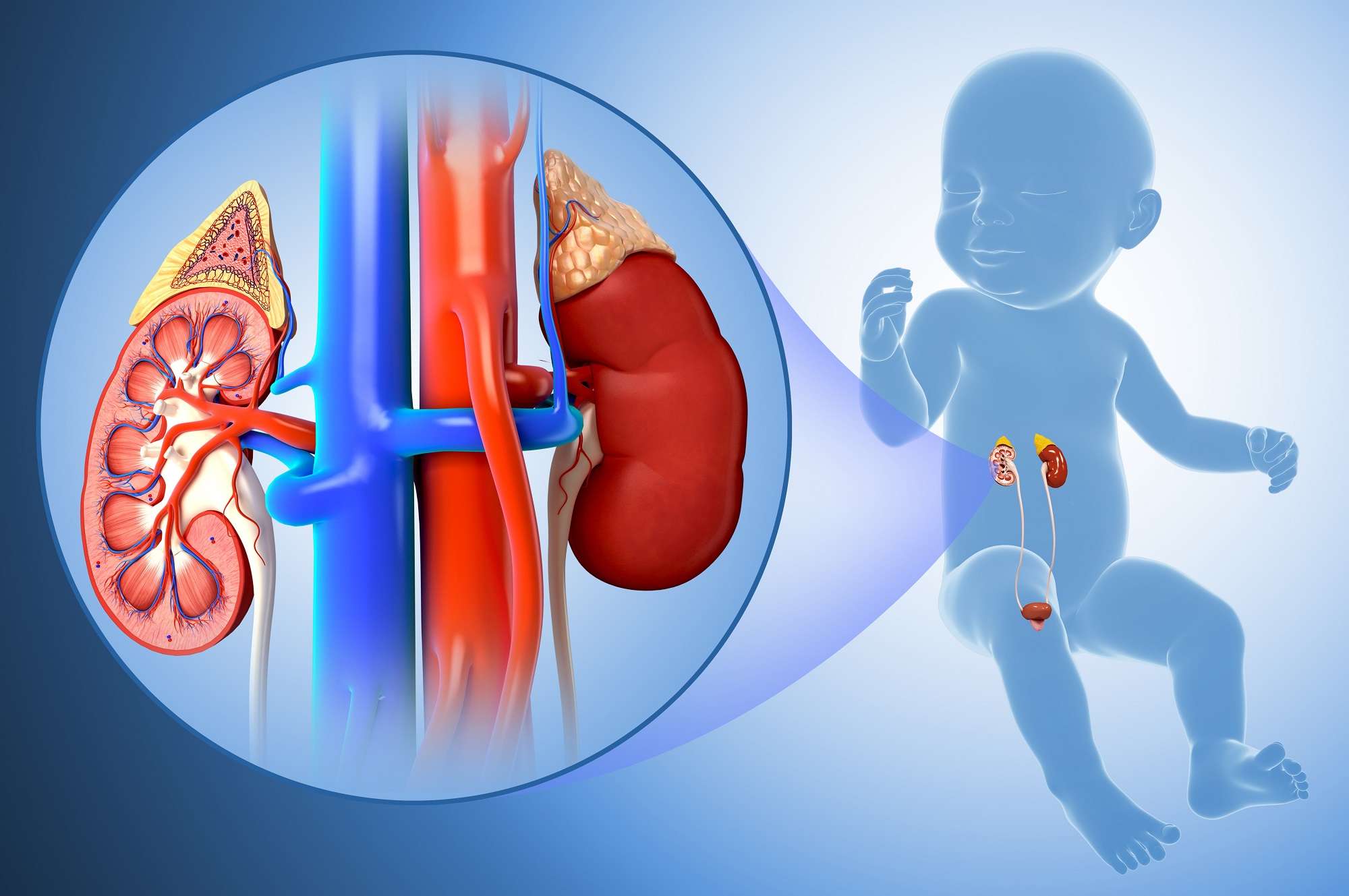 Enlarged Kidneys Noted in Neonates With Congenital Heart Disease