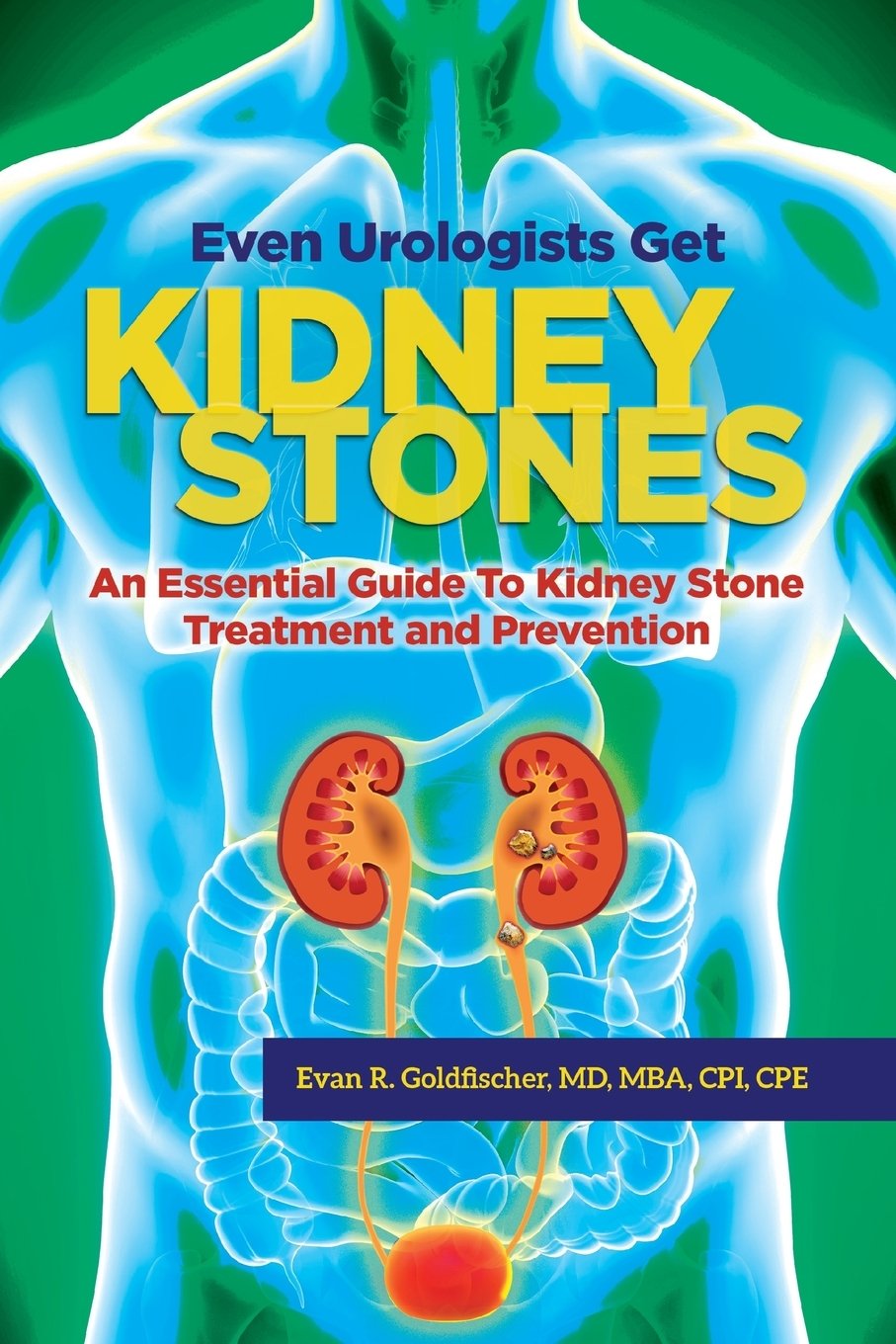 Even Urologists Get Kidney Stones : An Essential Guide to ...