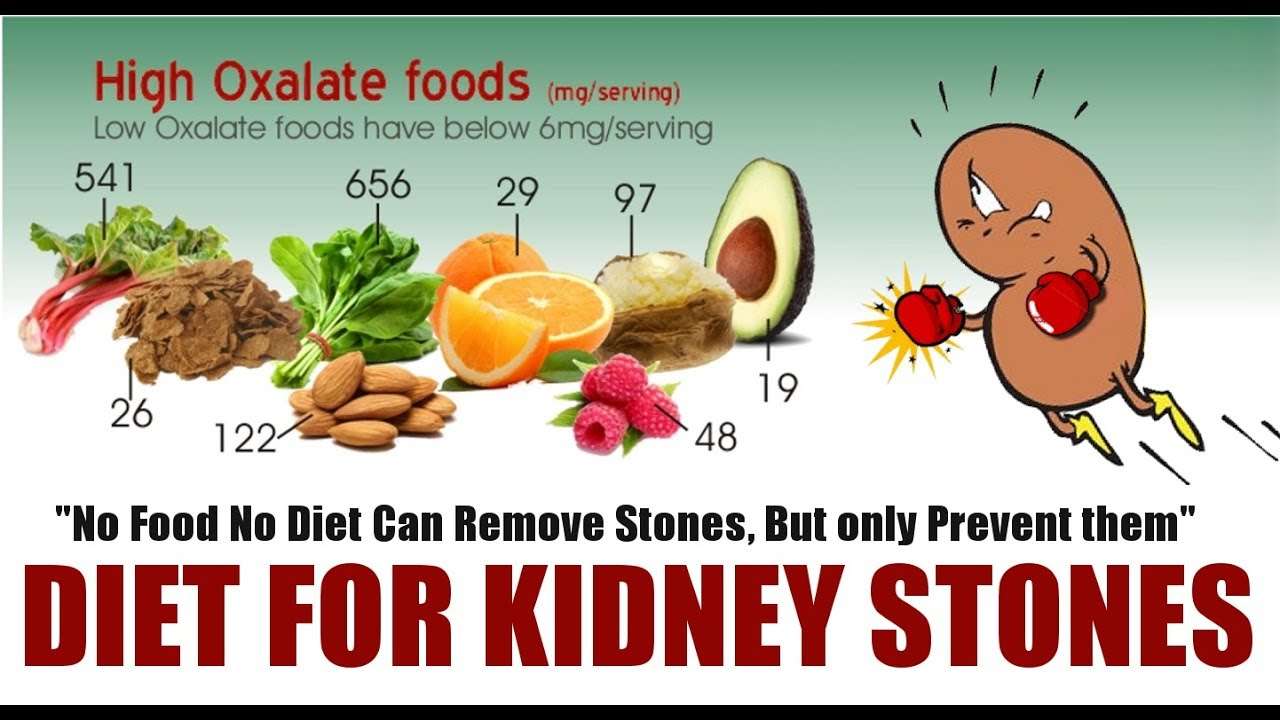 Food Diet For Kidney Stones Patients
