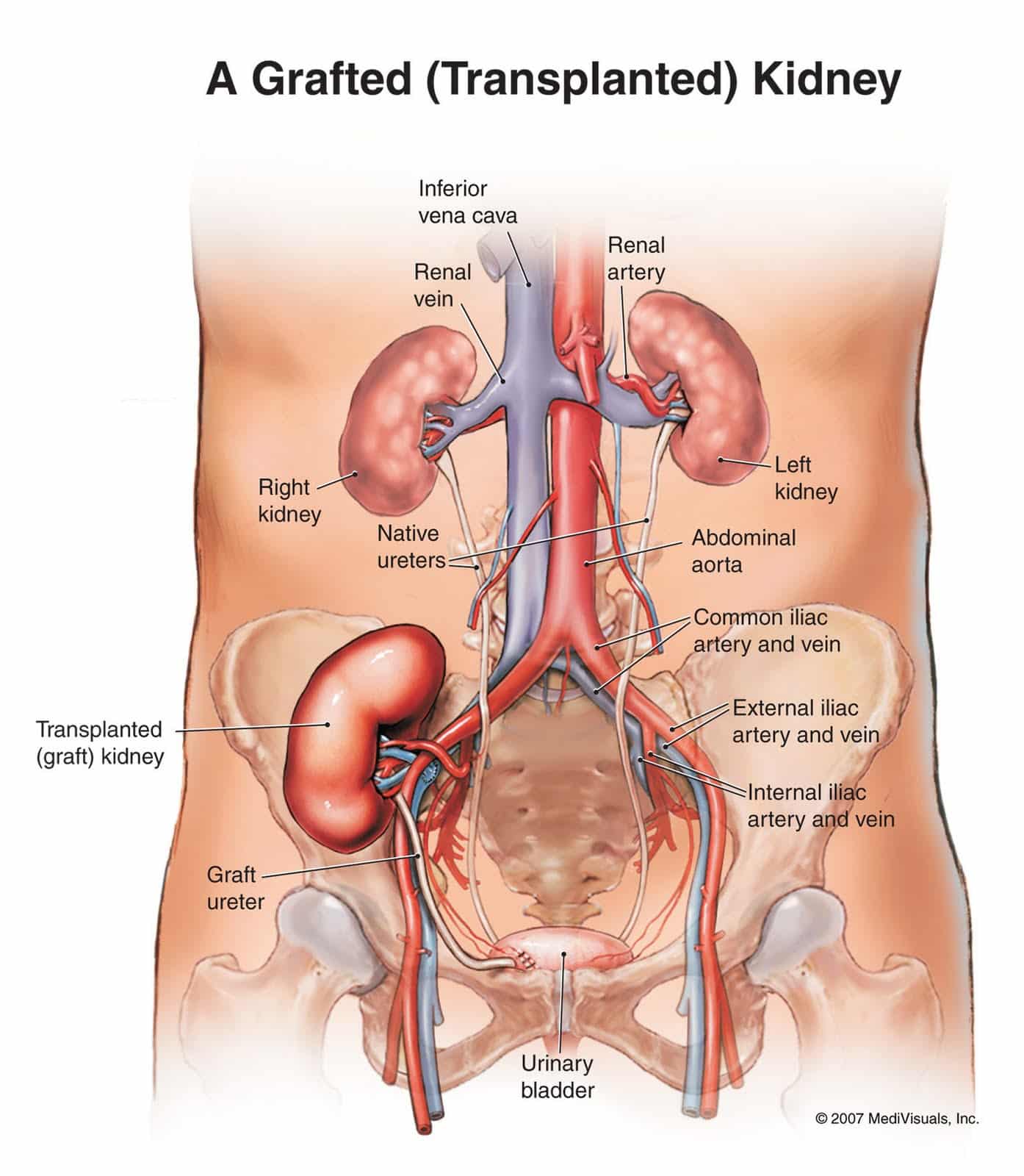 Free For Health: Kidney Pain Causes