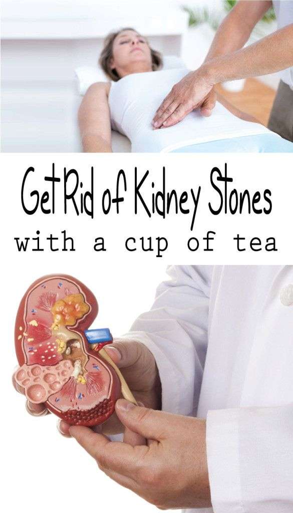 Get rid of Kidney Stones with a cup of Tea