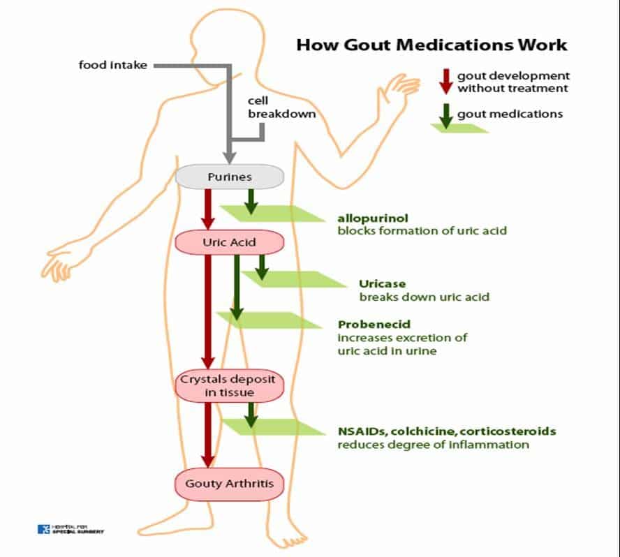 GET TO KNOW WHAT IS GOUT.....