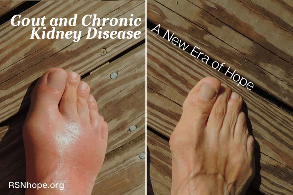 Gout and Chronic Kidney Disease