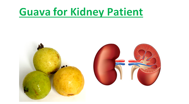 Guava For Kidney Patient, Diabetics and Cancer Patients ...