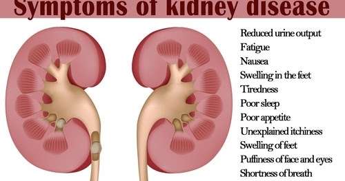 Health Knowledge : What are the dangerous symptoms of kidney failure