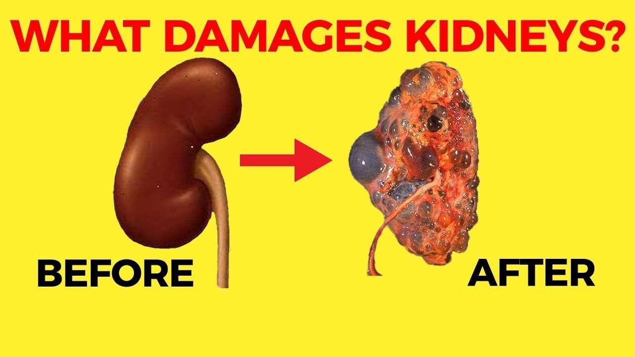 HEALTH: These 10 Habits may Damage your Kidneys and help to cause ...