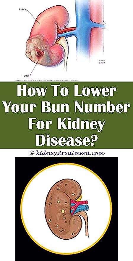 Here Are 10 Warning Signs Your Kidneys Are Not Working Properly Do Not ...