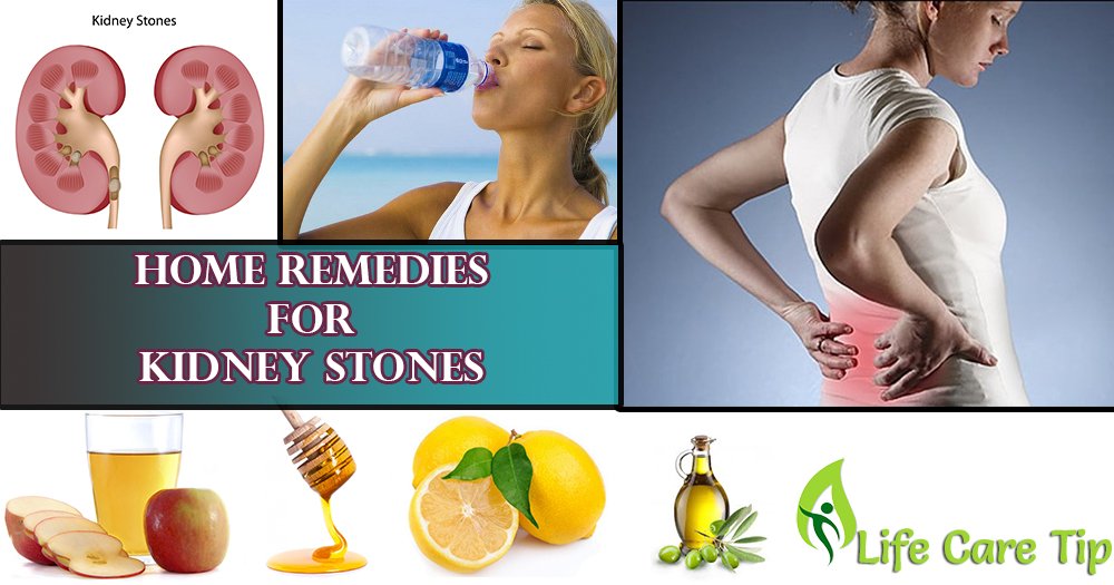 Home Remedies for Passing Kidney Stones quickly