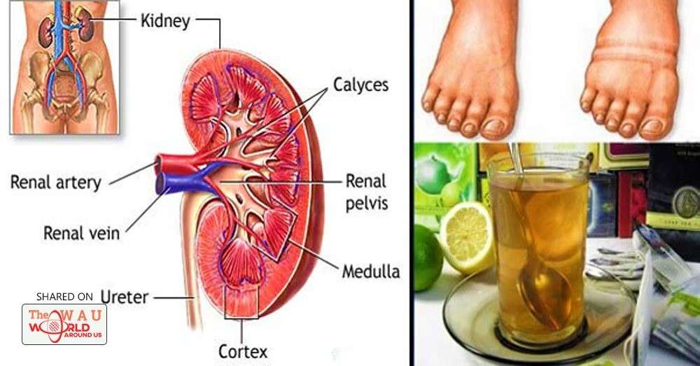 Homemade Remedy That Will Help You Cleanse Your Kidneys and Filter Your ...