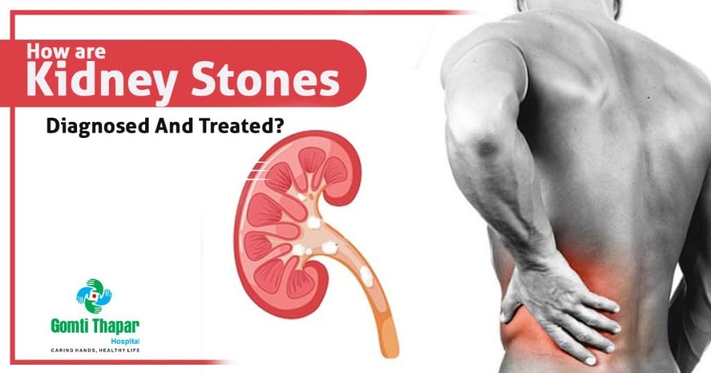How are Kidney Stones Diagnosed And Treated?