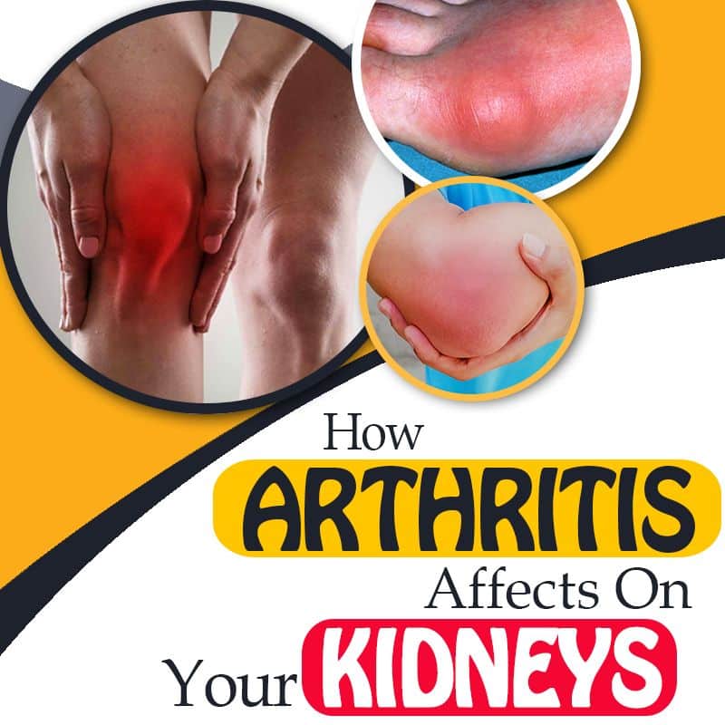 Can Kidney Disease Cause Arthritis HealthyKidneyClub