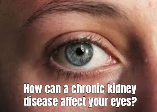 How can a chronic kidney disease affect your eyes?
