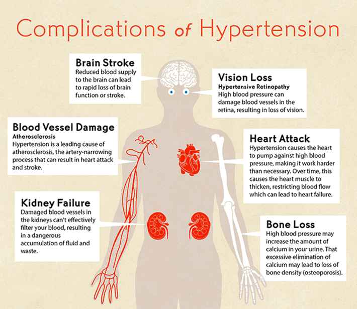 does-high-blood-pressure-cause-kidney-damage-healthykidneyclub