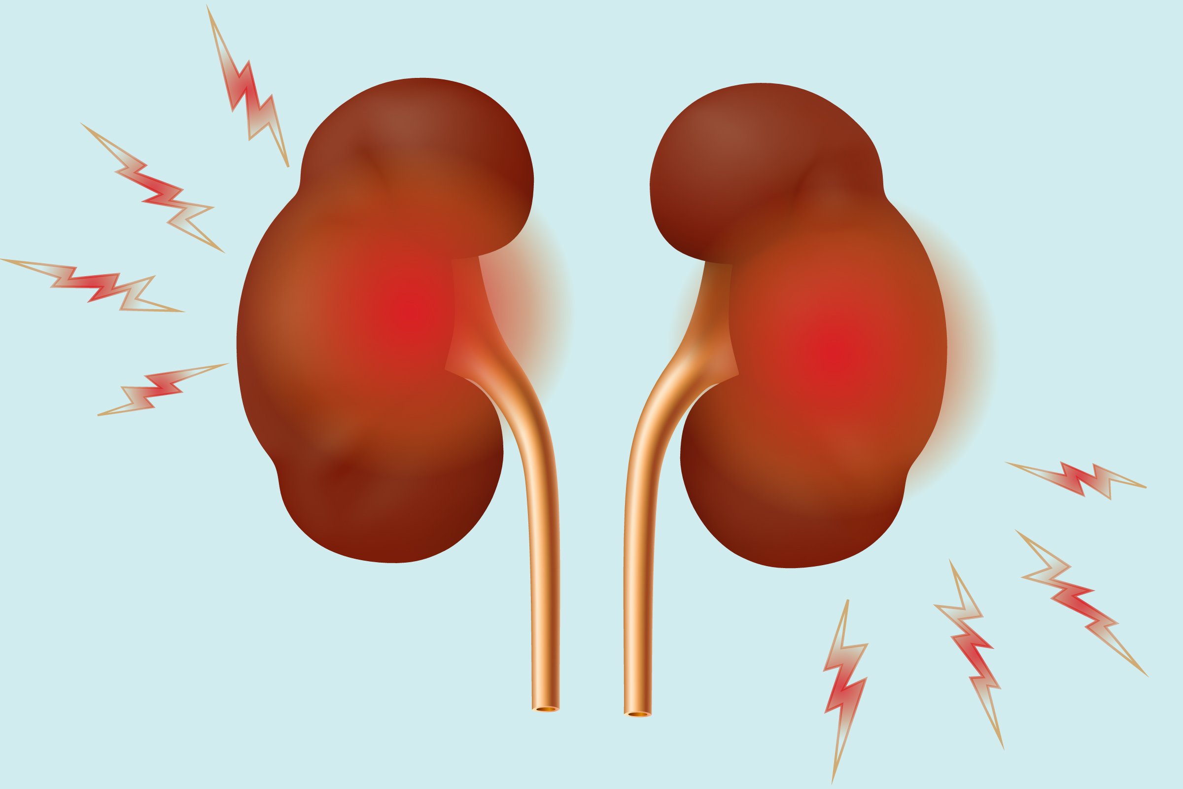 How Inflammatory Arthritis Affects the Kidneys
