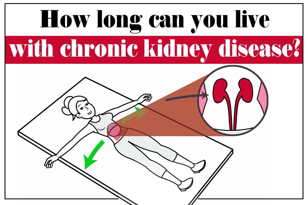 How Long A Chronic Kidney Disease Patient Live? Ayurved ...