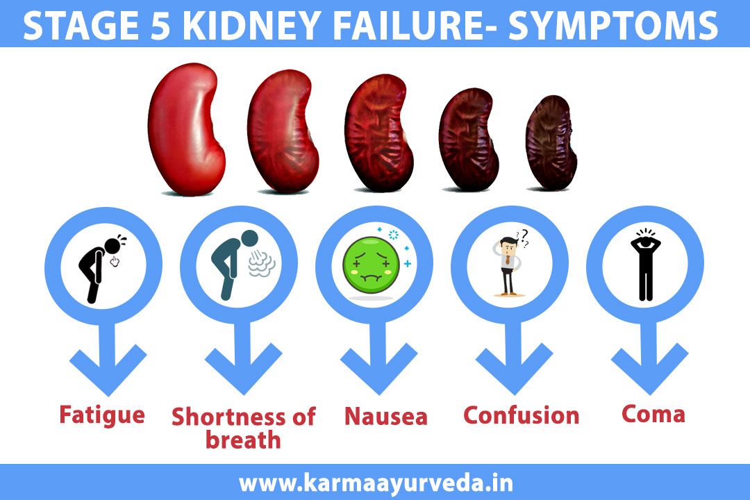 How Long Can A Person With Kidney Failure Survive Without ...