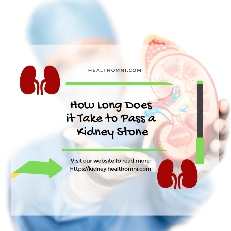 How Long Can Kidney Stones Take To Pass
