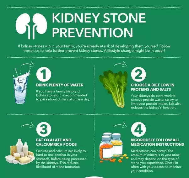 How painful are kidney stones?