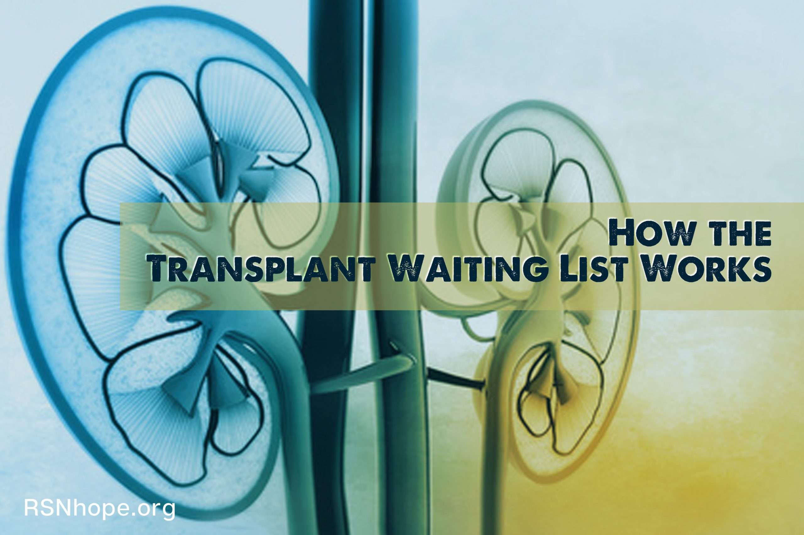 How the Transplant Waiting List Works