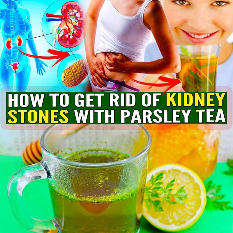 How To Get Rid Kidney Stones With Parsley Tea