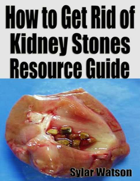 How to Get Rid of Kidney Stones Resource Guide by Sylar ...