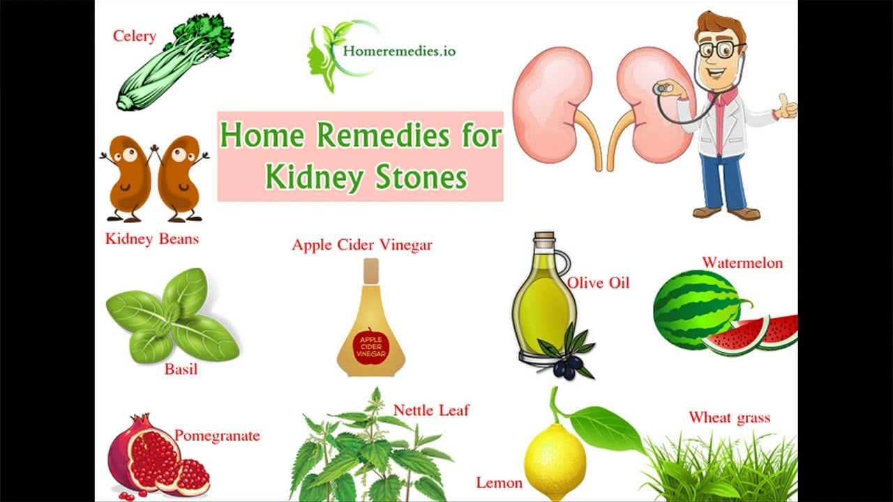 How To Help Pass A Kidney Stone Faster