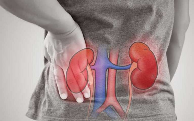 How to Keep Your Kidneys Healthy: 10 Ways To Fight Kidney ...