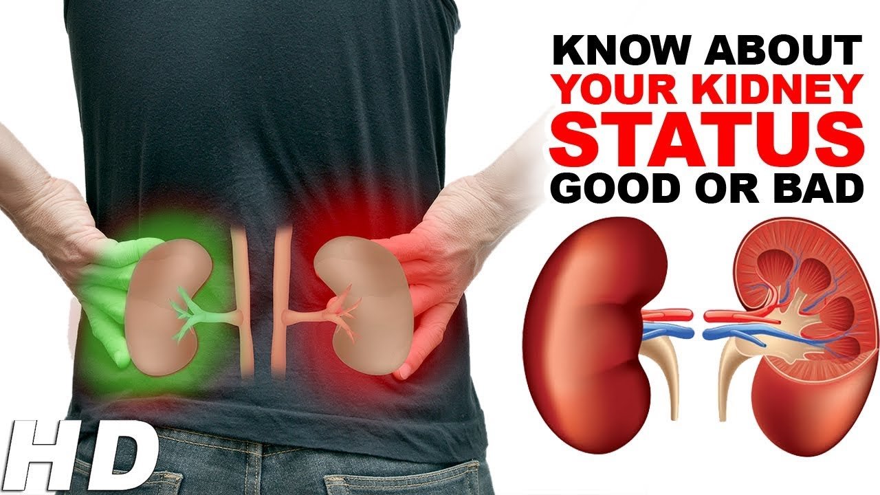How To Know About Your Kidney Status Good Or Bad ? Watch ...