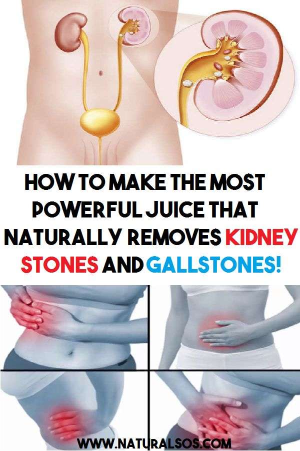 How To Make The Most Powerful Juice That Naturally Removes Kidney ...