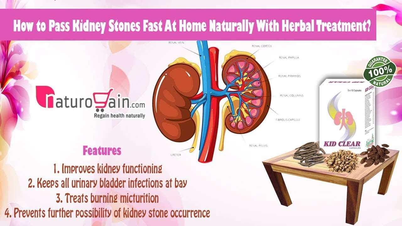 How to Pass Kidney Stones Fast At Home Naturally With Herbal Treatment ...