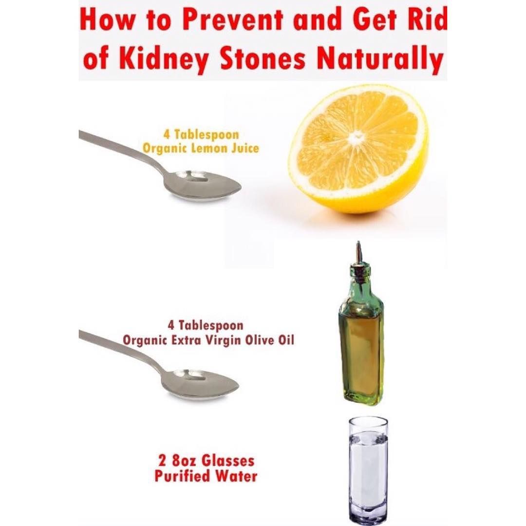 Best Way To Get Rid Of Kidney Stones Female