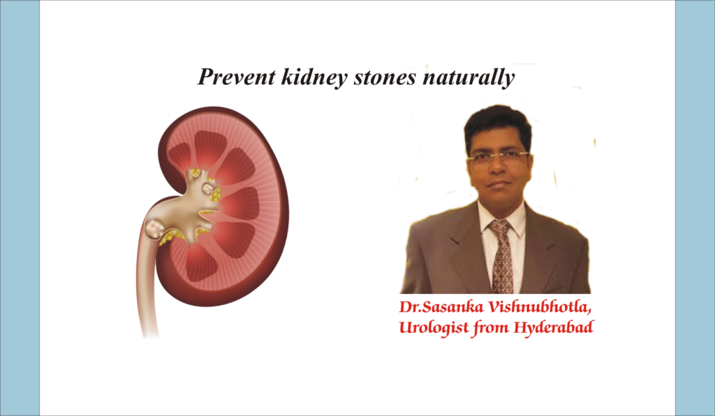 How to prevent kidney stones naturally