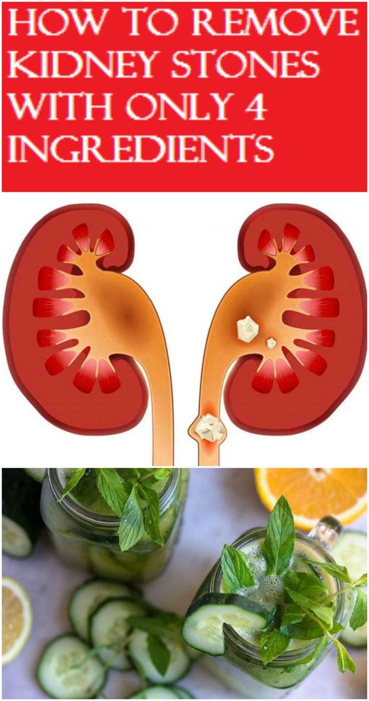 How To Remove Kidney Stones With Only 4 Ingredients