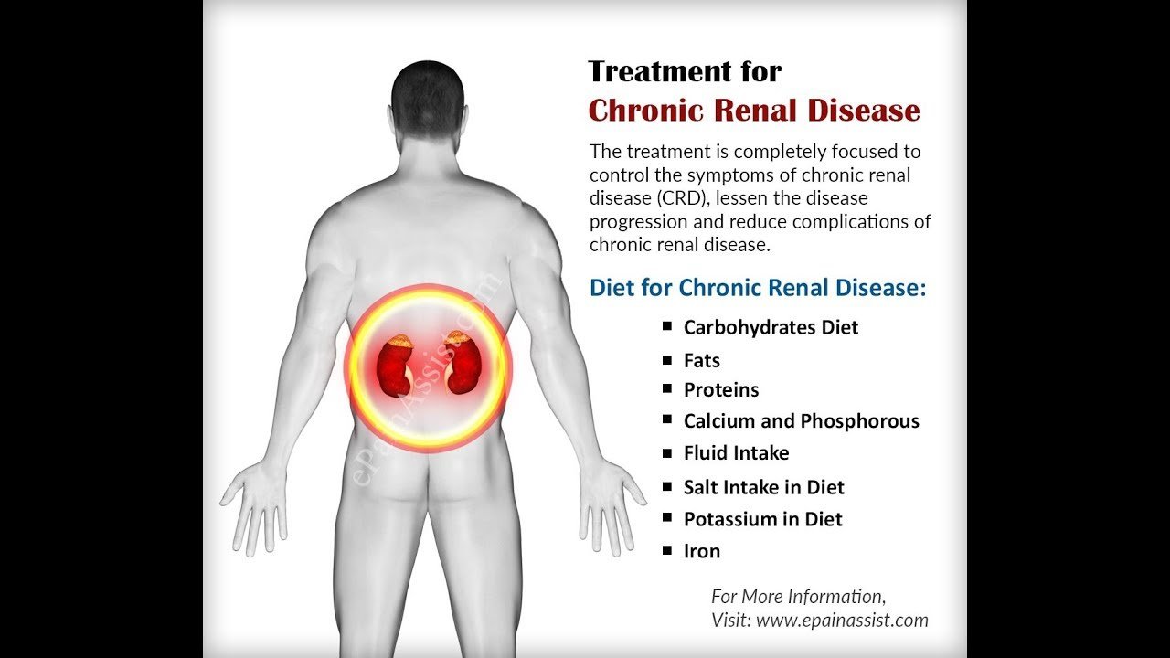How to Treat Kidney Disease With Natural Remedies