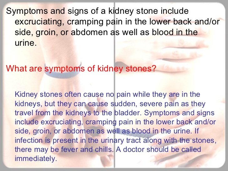 Identifying What are the Symptoms of Kidney Stones and ...