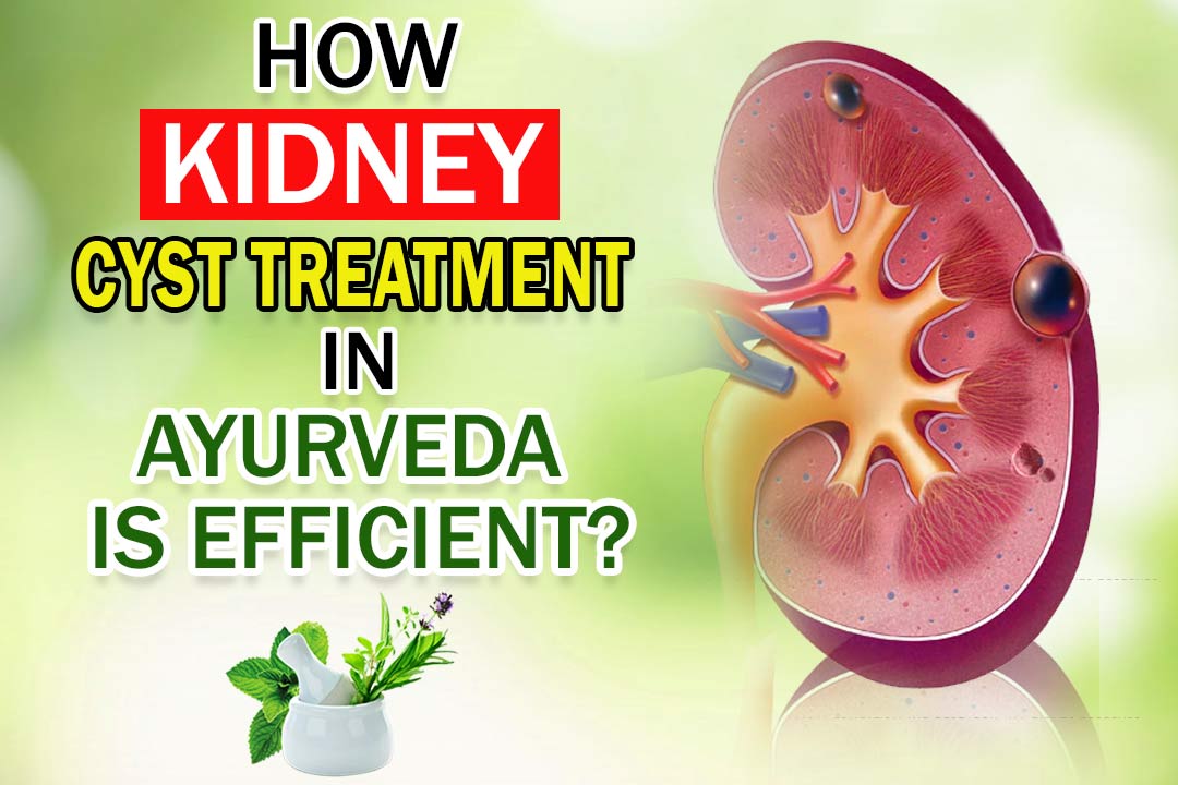Is Ayurvedic remedies for renal cyst efficient?