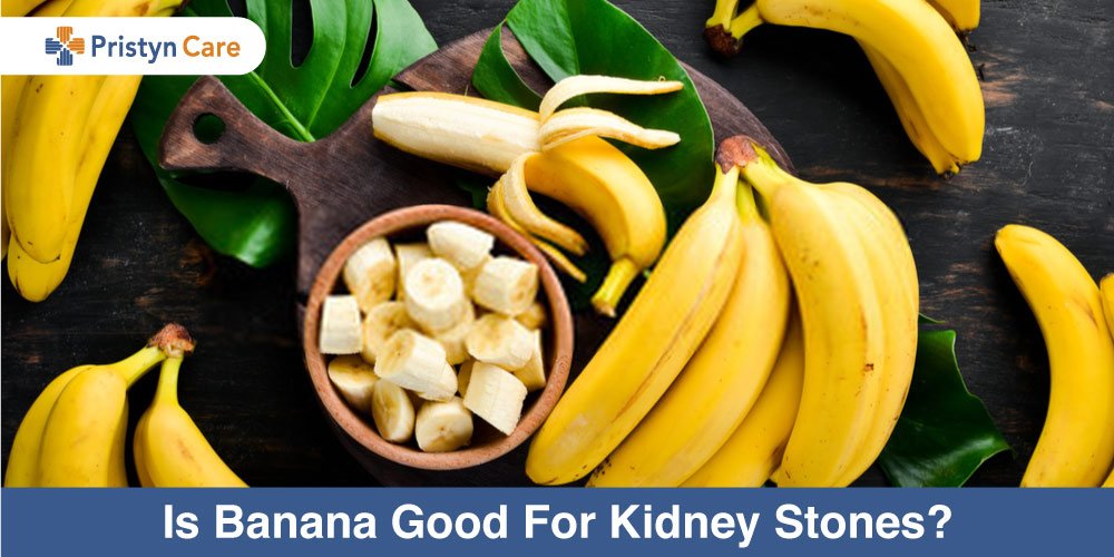Is Banana Good For Kidney Stones?