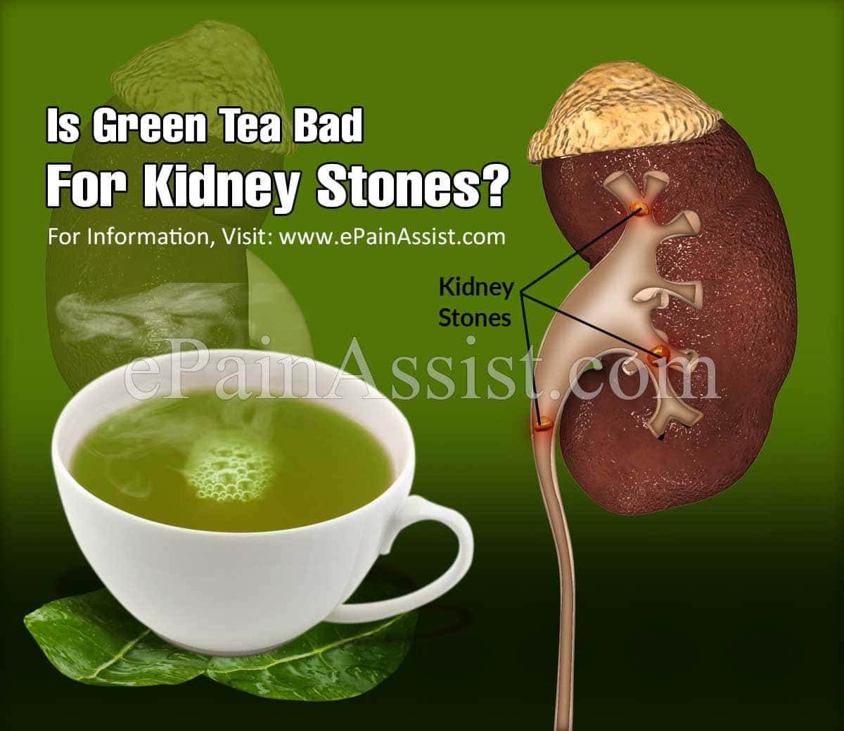 Is Coffee Ok For Kidney Stones
