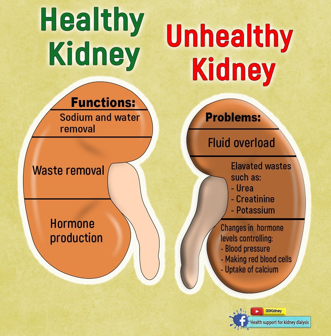 Is it really possible to get off kidney dialysis?: HOW DO KIDNEYS WORK?