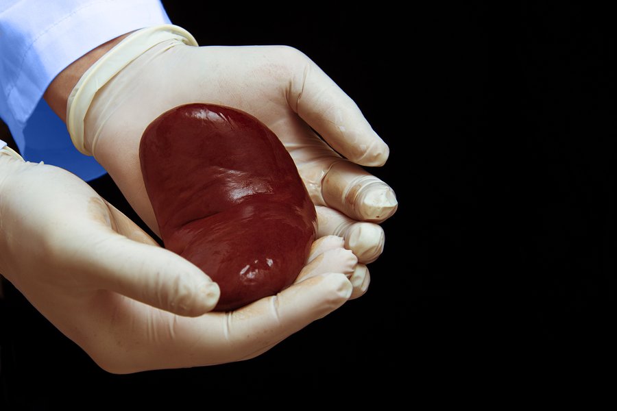 Its Time for a Kidney Market  InsideSources