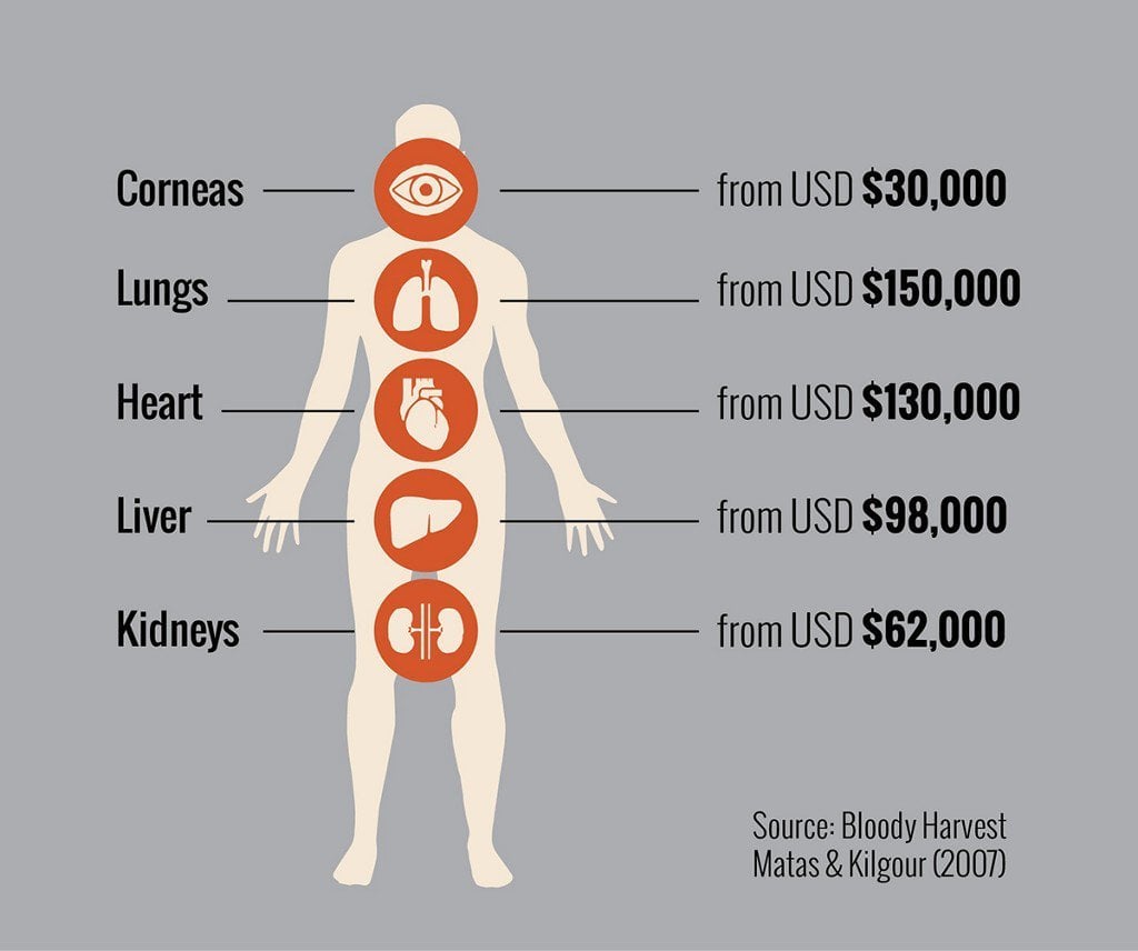 How Much Money Is A Kidney Worth