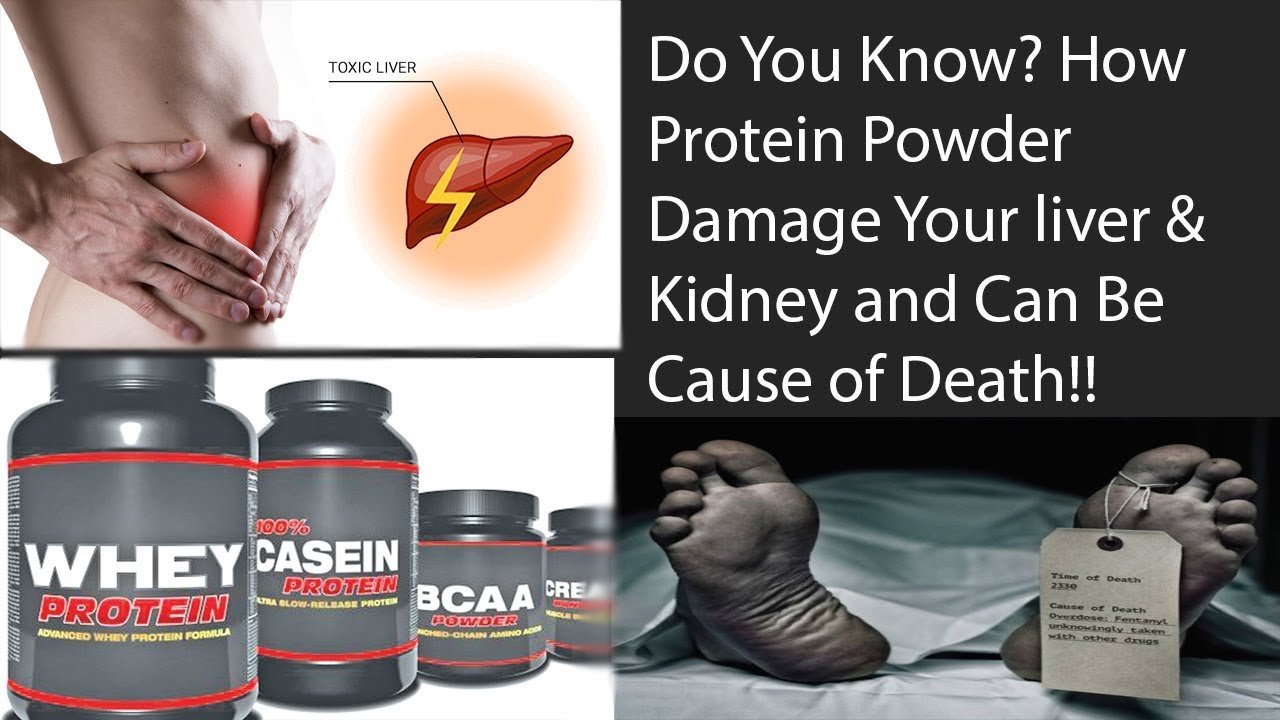 Kidney Damage From Protein Supplements