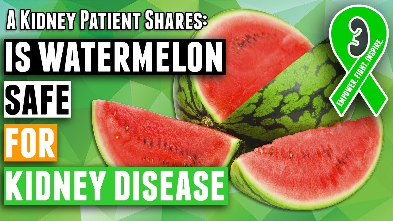 Kidney Diet Tips: Is watermelon safe for kidney disease ...