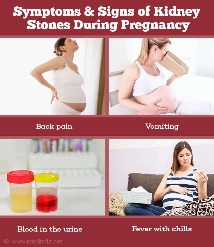 Kidney Discomfort While Pregnant