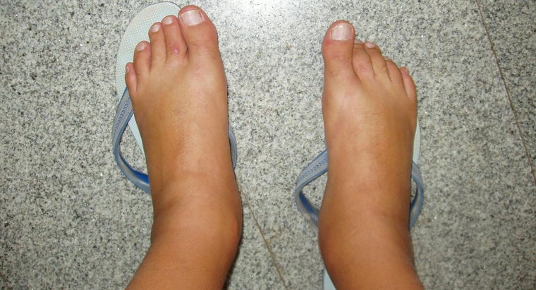 scientists-explain-6-things-that-cause-swollen-legs-and-how-to-fix-it