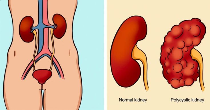 Kidney disease can best be treated when spotted earlier on.