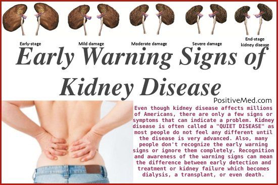 Kidney Disease Warning Signs
