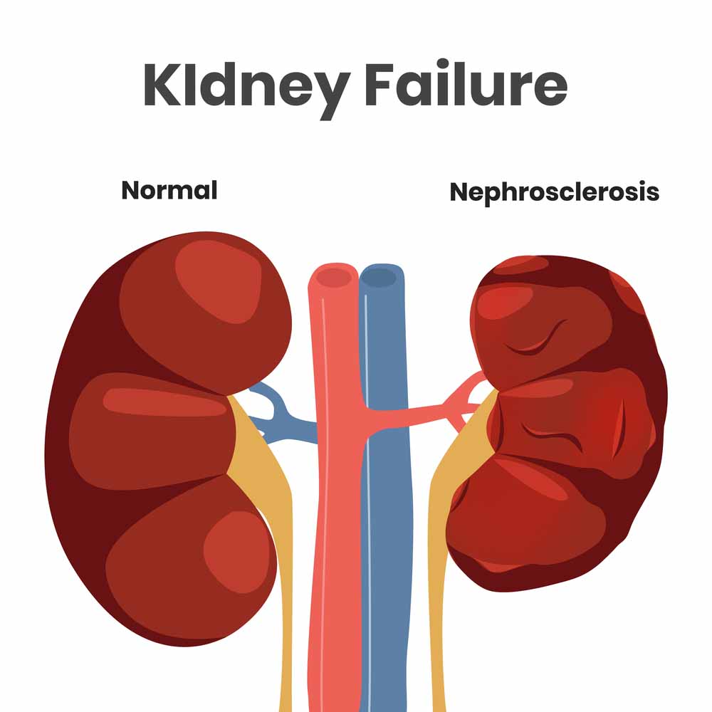 How Plausible Is This Situation Involving Kidney Failure