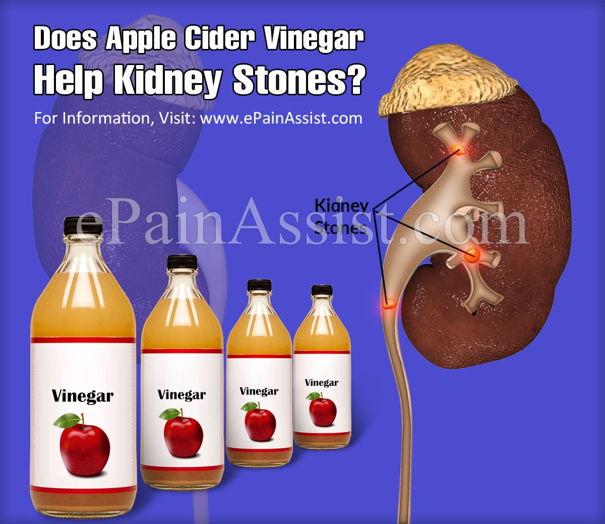 Kidney Flush Apple Juice